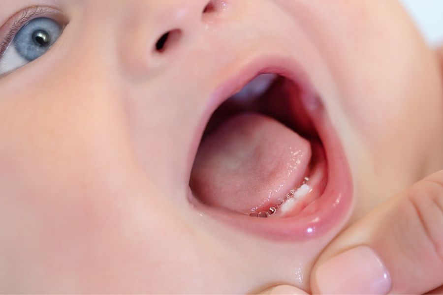W jakim momencie należy usunąć zęby mleczne u dziecka?